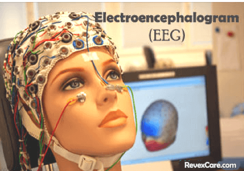 Brain Mapping Electroencephalography (EEG).png