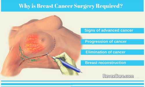 surgery to treat breast cancer