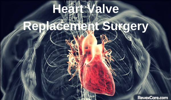 surgery for heart valve replacement