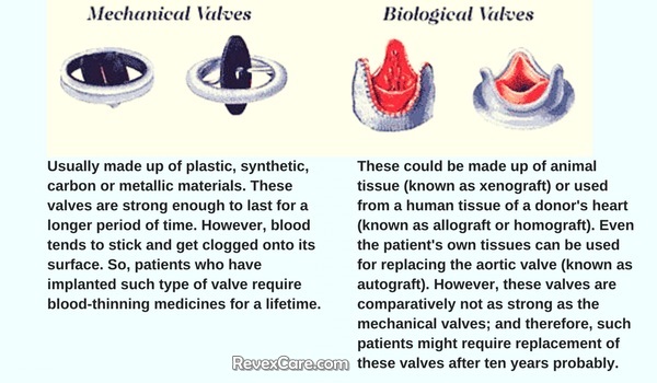 mechanical and biological valves used in aortic valve replacement surgery