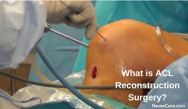 what is acl reconstruction surgery