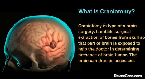 what is craniotomy