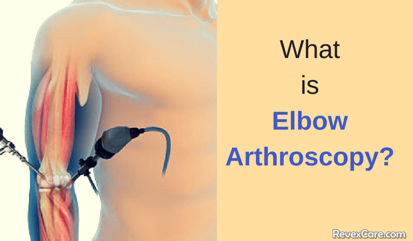 what is elbow arthroscopy